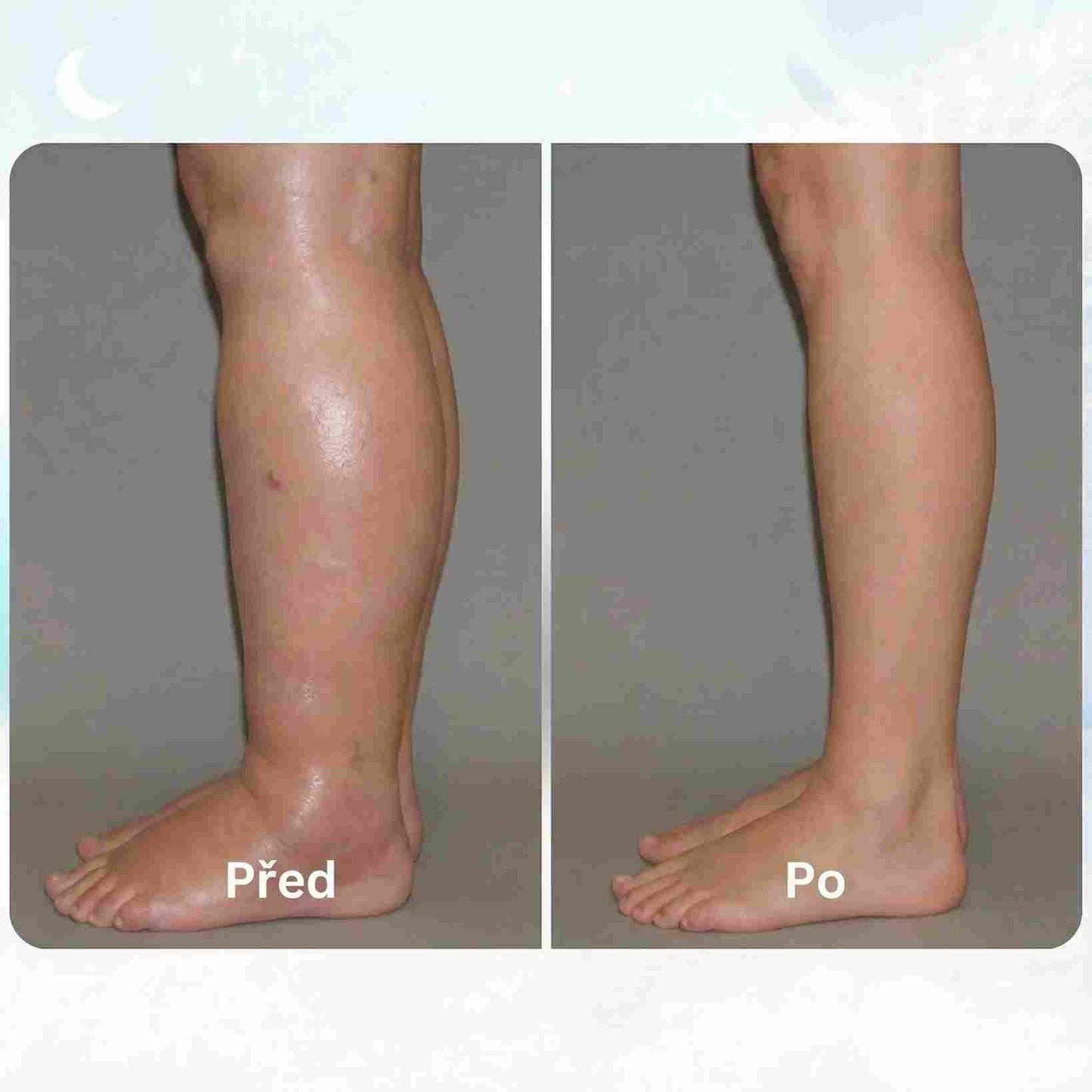 LOOMA - EMS VYŘEŠ OTEKLÉ NOHY Z DOMOVA