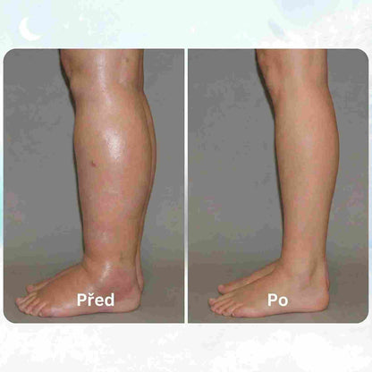 LOOMA - EMS VYŘEŠ OTEKLÉ NOHY Z DOMOVA