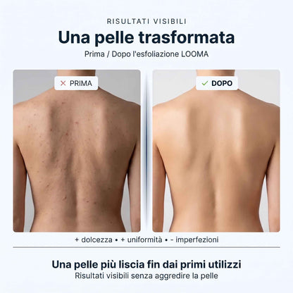 Asciugamano da doccia esfoliante LOOMA